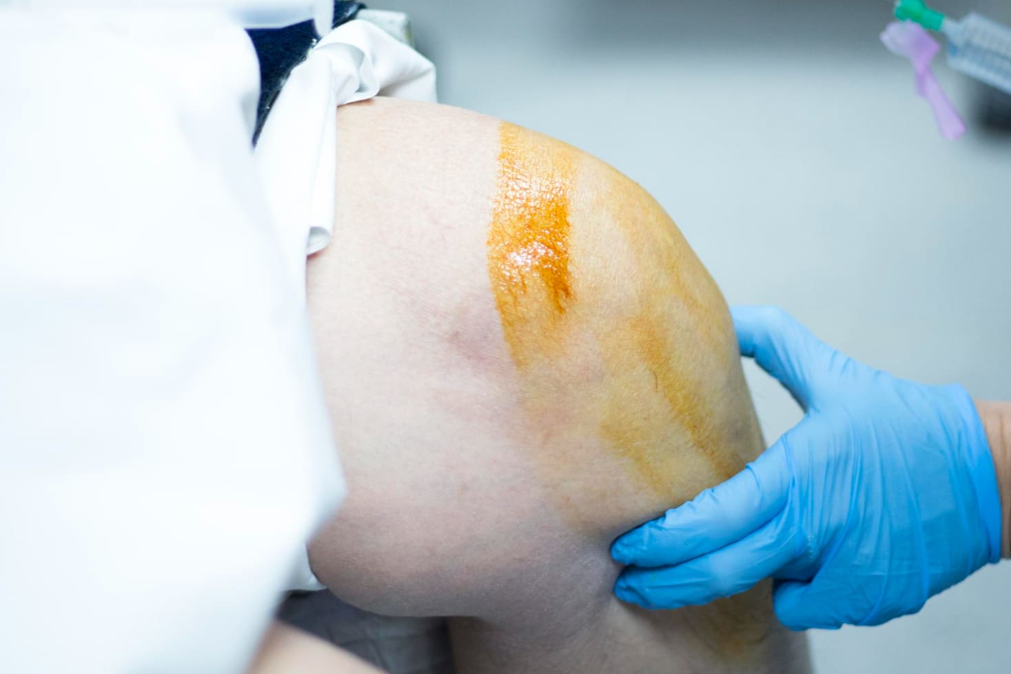 Infiltración articular